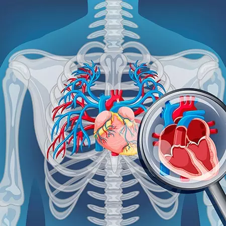 Podnyat Fraktsiyu Vyibrosa Serdtsa 1 Min