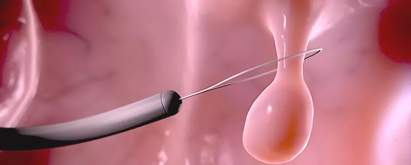 90593c77261cec1180685fadb8de3e75