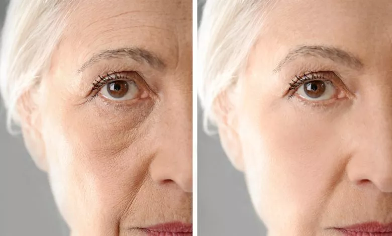 Ujieve01h7vpmzbv1v1c1psrpyvuxnle1auxmqvp